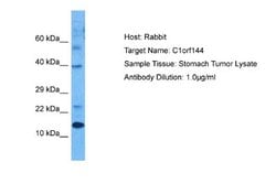 SZRD1 Rabbit anti-Human, Polyclonal, Novus Biologicals 0.1 mL | Buy Online | Novus Biologicals | Fisher Scientific